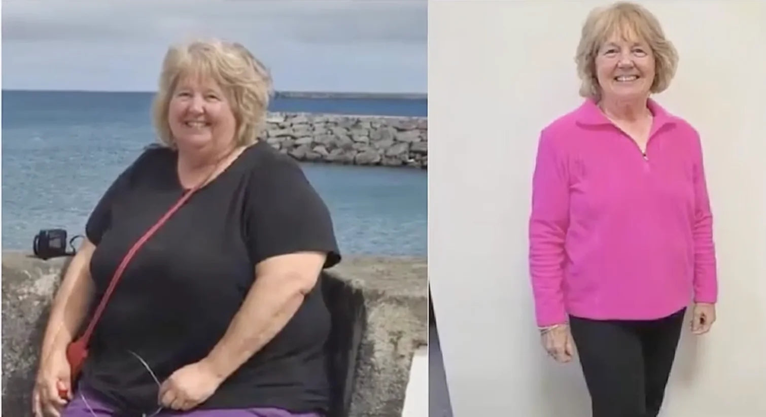 Linda W., 63 — Retired Teacher, Asheville, NC before and after