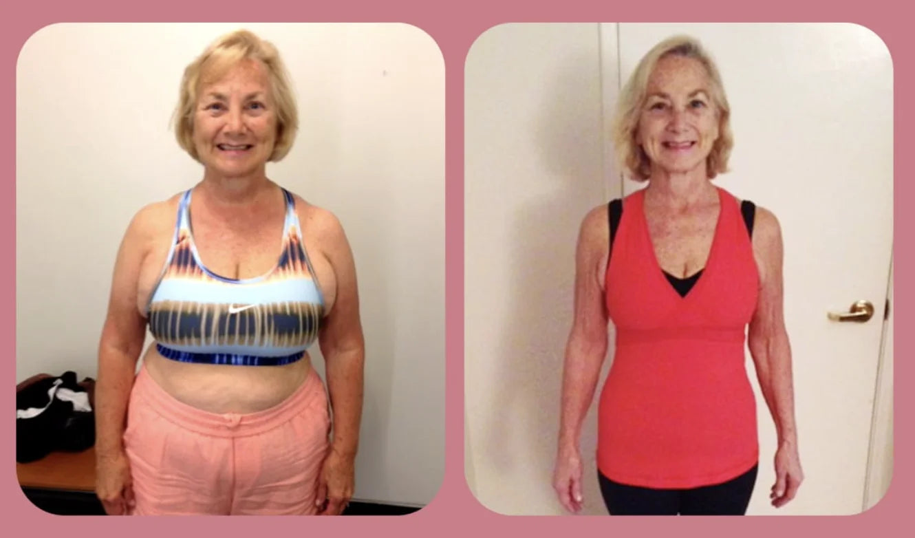 Diane P., 71 — Retired, Mesa, AZ before and after
